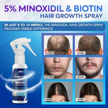 5% Minoxidil for Men Hair, Minoxidil Spray, Minoxidil for Women Hair Growth, Minoxidil for Men Beard...