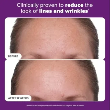 Win Against Aging with Paula's Choice Retinol Treatment