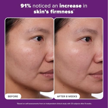 Win Against Aging with Paula's Choice Retinol Treatment