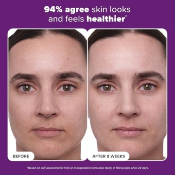 Win Against Aging with Paula's Choice Retinol Treatment