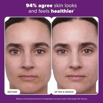 Win Against Aging with Paula's Choice Retinol Treatment