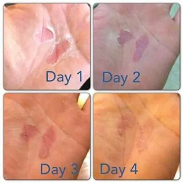 RipFix Hand Tear Repair - Rip Fix Stopper Balm for Gymnastics - Climbers Hand Balm - Wod Callus Hand Care - Climbing Hand Repair Balm Cream - Treatment for Cracked or Ripped Hands Classic 1.34 oz Tin