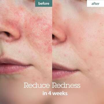 BLITHE Pressed Serum Crystal Iceplant Face Moisturizing Gel - Kbeauty Best Skin Cream for Dry Skin, Korean Serum for Combination Skin & Redness Relief, Face Moisturizer for Dry Skin Cream 1.68 Oz