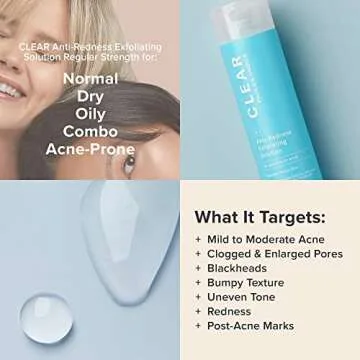 Paula's Choice CLEAR Anti-Redness Exfoliating Solution, 2% Salicylic Acid Exfoliant, for Mild to Severe Acne & Breakouts, Blackheads and Clogged Pores, Fragrance-Free, 4 Fl. Oz