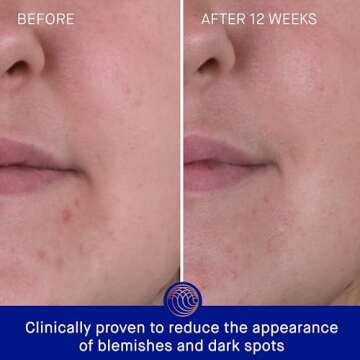 Augustinus Bader The Rich Cream 30ml