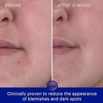 Augustinus Bader The Rich Cream 30ml - Luxury Skincare