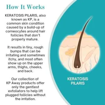KPAWAY Keratosis Pilaris Treatment Lipid Repair Emollient, Baby Friendly, Strawberry Legs Treatment, Keratosis Pilaris Lotion 16oz