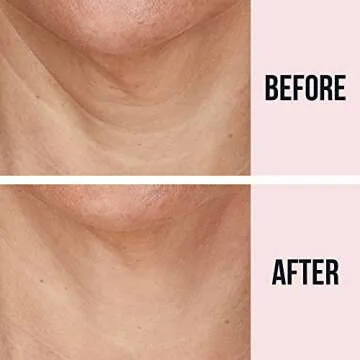 SiO Beauty FaceLift - Neck, Forehead, Eye & Smile Anti-Wrinkle Patches - Overnight Smoothing Silicone Patches For Face, Neck, Forehead, Eye & Smile Fine Lines And Signs Of Aging