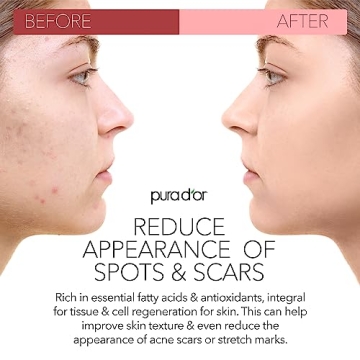 PURA D'OR Organic Rosehip Oil - 100% Pure Nourishment