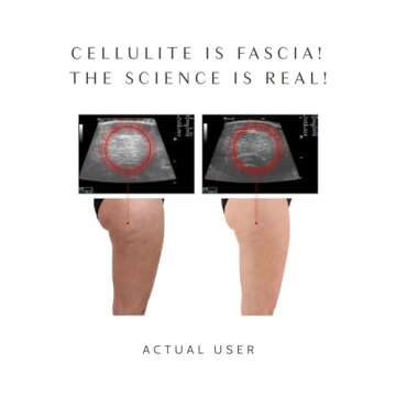 Ashley Black’s FasciaBlaster Trigger Point Fascia Tools for Recovery, Anti-Cellulite and Skin Soothing (FasciaBlaster)