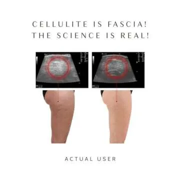 Ashley Black’s FasciaBlaster Trigger Point Fascia Tools for Recovery, Anti-Cellulite and Skin Soothing (FasciaBlaster)