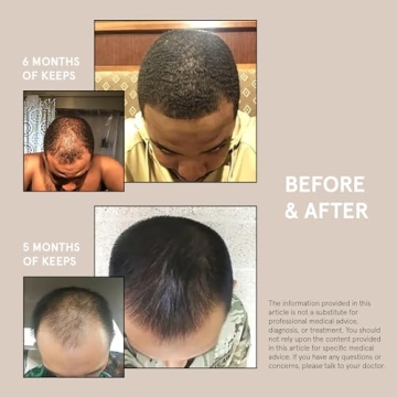 Keeps Extra Strength Minoxidil for Men - 3 Month Supply 5% Solution