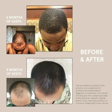 Keeps Extra Strength Minoxidil for Men - 3 Month Supply 5% Solution