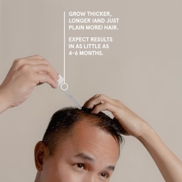 Keeps Extra Strength Minoxidil for Men - 3 Month Supply 5% Solution