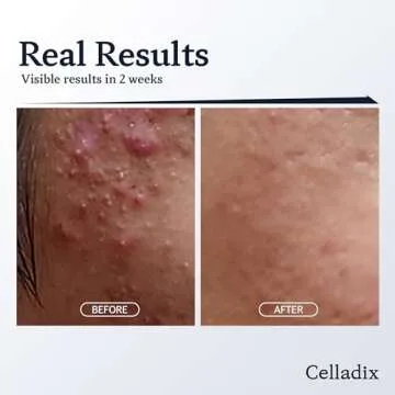 Celladix Sebum Rebalancing Rx 131 Ampoule | Minimize Sebum Serum | Tighten Enlarged Pores | Repair Skin Barrier | Rapid Soothing for Daily Use | Oily & Combination Skin | 0.68 Fl Oz