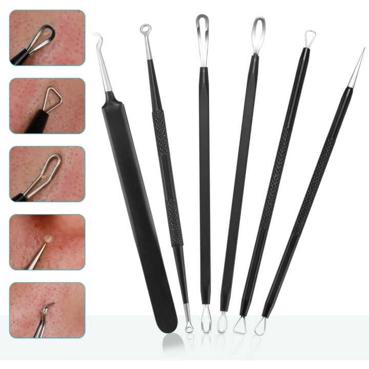 Blackhead Remover Tool Kit - 6 Professional Stainless Tools