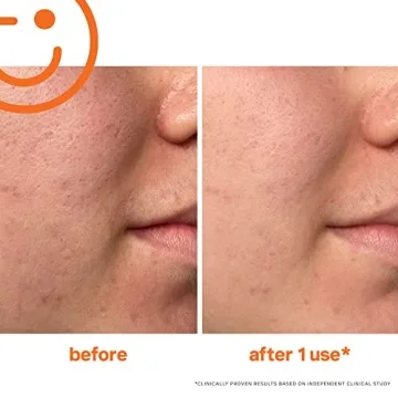 Kate Somerville ExfoliKate Intensive Exfoliating Treatment