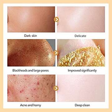 CIDBEST Blackhead Remover Mask with 24K Gold Formula