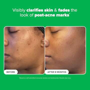 Paula’s Choice BOOST 10% Azelaic Acid Oil-Free Serum