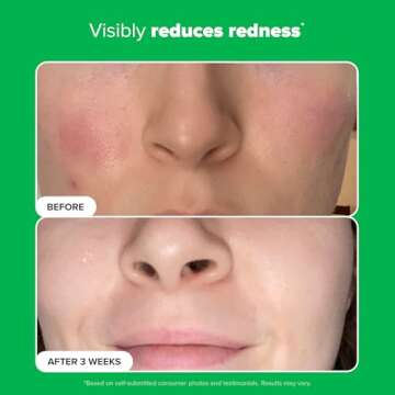 Paula’s Choice BOOST 10% Azelaic Acid Oil-Free Serum