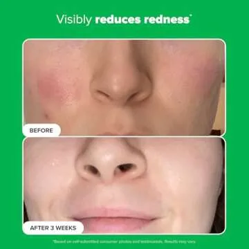 Paula’s Choice BOOST 10% Azelaic Acid Oil-Free Serum