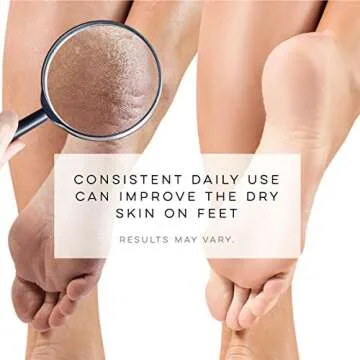 LE EMILIE Moisturizing Gel Heel Socks | Perfect for Healing Dry Cracked Heels and Feet | Infused with Aromatherapy Blend of Lavender and Jojoba Oil | 1 Pair, GREEN