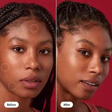 Rescue Balm +Dark Spot Retouch Post-Blemish Recovery Cream from Hero Cosmetics - Nourishing and Calming After a Blemish - Corrects Discoloration - Dermatologist Tested (0.507 fl. oz)