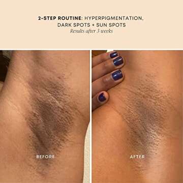 Bushbalm Dark Spot Oil for Skin Clarity - 30ml