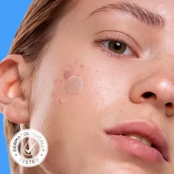 Avarelle Acne Patches - Fast-acting Hydrocolloid Zit Solution