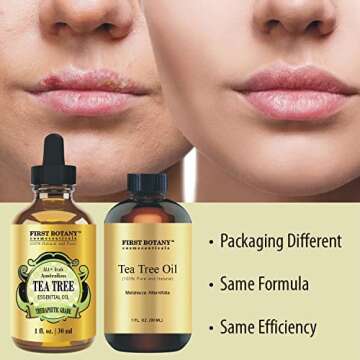 First Botany, 100% Pure Australian Tea Tree Essential Oil with high conc. of Terpinen - A Known Solution to Help in Fighting Acne, Toenail Issues, Dandruff. (1 fl oz)