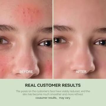 WNP Duo Cleansing Clay Mask with Niacinamide & Hyaluronic Acid – Deep Pore Cleanser for T-Zone & U-Zone, Blackhead Remover, Hydrating & Oil-Control Face Mask, 3.53oz