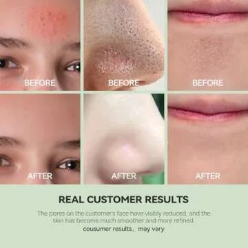 WNP Duo Cleansing Clay Mask with Niacinamide & Hyaluronic Acid – Deep Pore Cleanser for T-Zone & U-Zone, Blackhead Remover, Hydrating & Oil-Control Face Mask, 3.53oz