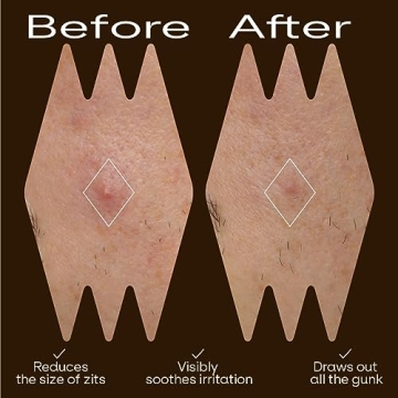 Cute Hydrocolloid Pimple Patches with Unique Designs