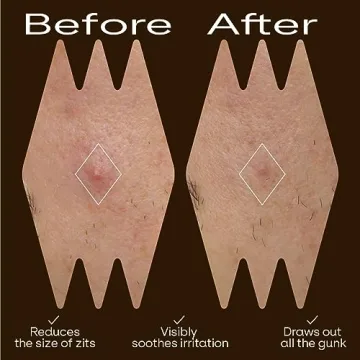 Cute Hydrocolloid Pimple Patches with Unique Designs