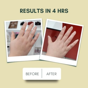 IMARAÏS Beauty Depuff Gummy - Vegan Skin & Gut Health