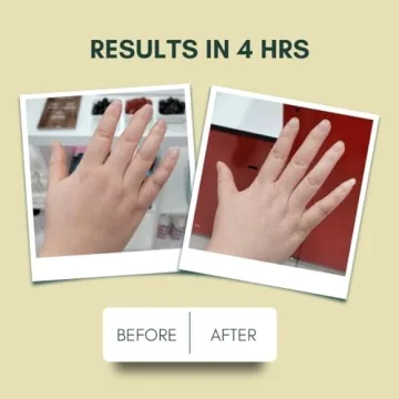 IMARAÏS Beauty Depuff Gummy - Vegan Skin & Gut Health