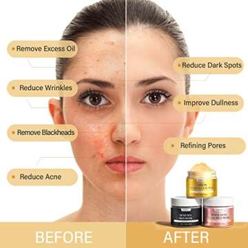 YLNALO Clay Facial Mask Gift Set -Turmeric Vitamin C, Dead Sea and Himalayan Clay Mask, SPA Facial M...