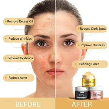 YLNALO Clay Facial Mask Gift Set -Turmeric Vitamin C, Dead Sea and Himalayan Clay Mask, SPA Facial M...