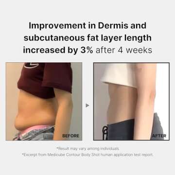 Medicube Age-R Contour Body Shot - A Body Slim Contouring Device - Improvement in Sagging Arms and Thigh Skin Texture - Achieve Smooth and Elastic Body at home - Korea Skin Care