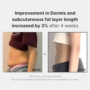 Medicube Age-R Contour Body Shot Device for Flawless Skin