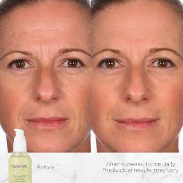 NassifMD Hydro-Screen Serum: Hydrating Anti-Aging Solution for All Skin Types