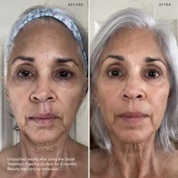 SK-II Facial Treatment Essence - Anti-Aging Essence Skincare to Help Reduce the Appearance of Fine L...