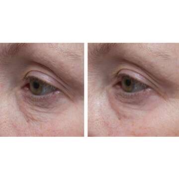 Dr. Denese SkinScience Firming Facial Collagen Eye Cream Face Moisturizer Hyaluronic Acid & Peptides Rejuvenate Skin - Improved Look of Fine Lines, Elasticity, Sagginess, Bags - Cruelty-Free - 1oz