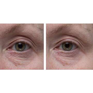 Dr. Denese SkinScience Firming Facial Collagen Eye Cream Face Moisturizer Hyaluronic Acid & Peptides Rejuvenate Skin - Improved Look of Fine Lines, Elasticity, Sagginess, Bags - Cruelty-Free - 1oz