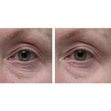 Dr. Denese SkinScience Firming Facial Collagen Eye Cream Face Moisturizer Hyaluronic Acid & Peptides Rejuvenate Skin - Improved Look of Fine Lines, Elasticity, Sagginess, Bags - Cruelty-Free - 1oz