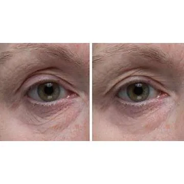 Dr. Denese SkinScience Firming Facial Collagen Eye Cream Face Moisturizer Hyaluronic Acid & Peptides Rejuvenate Skin - Improved Look of Fine Lines, Elasticity, Sagginess, Bags - Cruelty-Free - 1oz