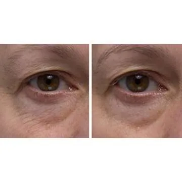 Dr. Denese SkinScience Firming Facial Collagen Eye Cream Face Moisturizer Hyaluronic Acid & Peptides Rejuvenate Skin - Improved Look of Fine Lines, Elasticity, Sagginess, Bags - Cruelty-Free - 1oz