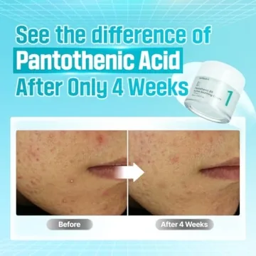 Numbuzin No.1 Cream for Oily Skin Hydration