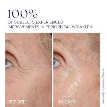 iS CLINICAL Youth Eye Complex, Anti-Aging Brightening Under Eye Cream, Reduces Puffiness, Hydrating and Firming Eye Cream