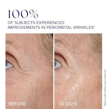 iS CLINICAL Youth Eye Complex, Anti-Aging Brightening Under Eye Cream, Reduces Puffiness, Hydrating and Firming Eye Cream